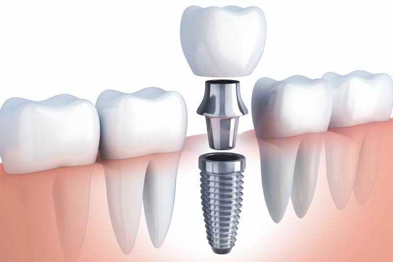 Affinity Dental of South Windsor Special Offer