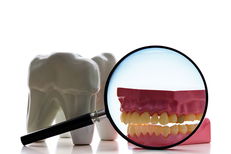 Root Canal in South Windsor