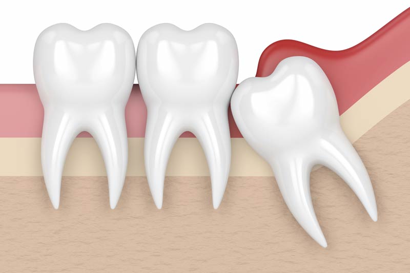 Oral Surgery in South Windsor